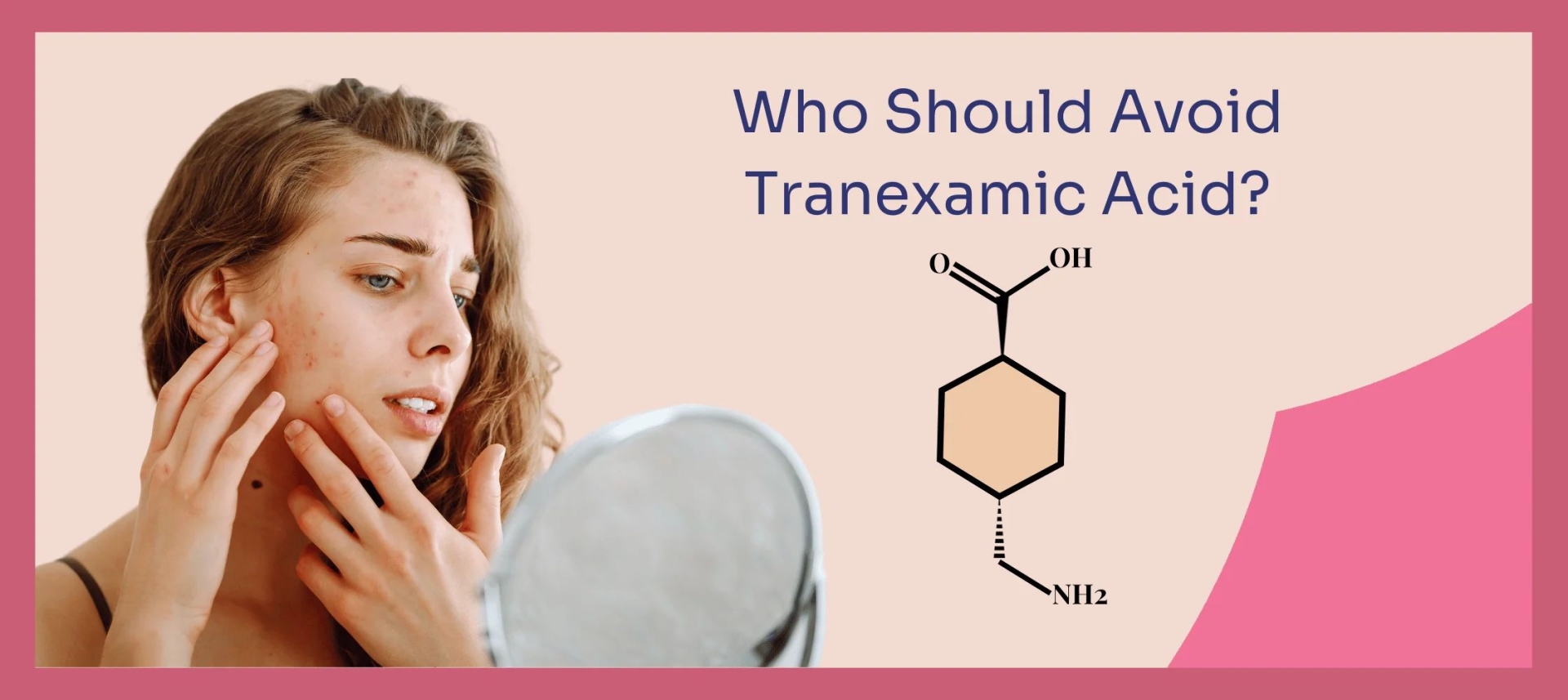 网红“氨甲环酸”被批准用于色斑治疗了吗？